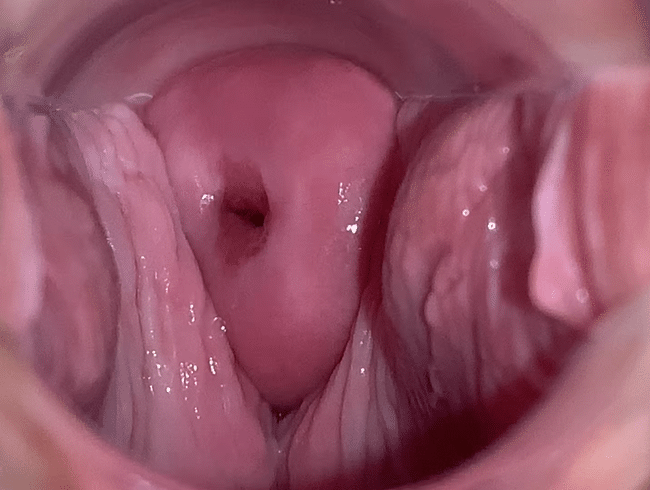 Untersuchung des Gebärmutterhalses. Was ist los mit meiner Vagina?